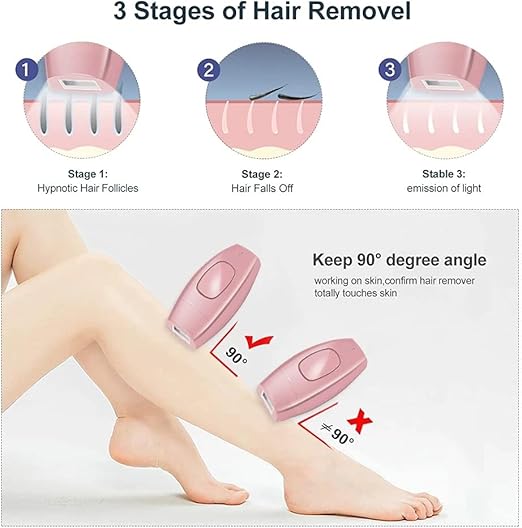 IPL  Laser Hair Removal