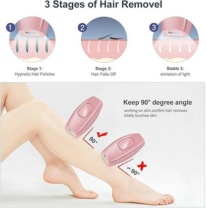 IPL  Laser Hair Removal